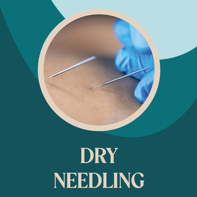 dry-needling